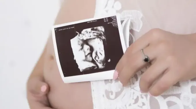 ecografia-pixabay070722_1.webp ?? 