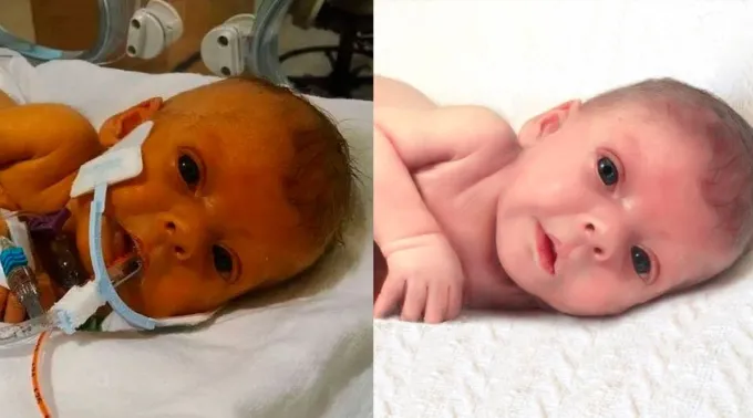 fotobebereddit.jpg ?? 