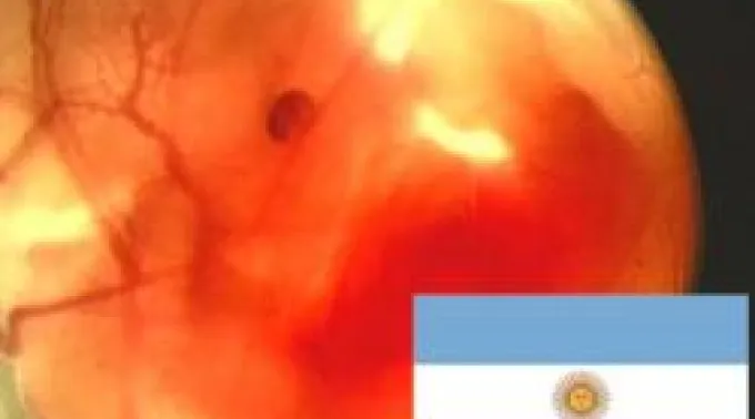 ppabortoargentina090611.jpg ?? 