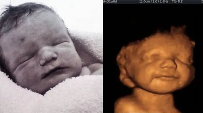 ppbebeeco160113.jpg ?? 