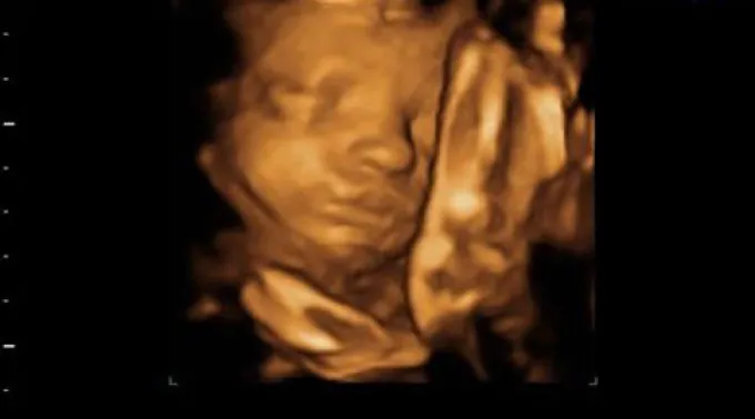 ppbebesbostezo2012.jpg ?? 