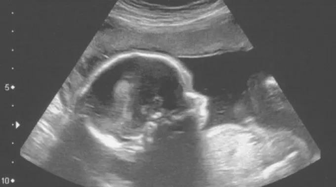 ppecografiYa_Richard_Mansfield_CC_BY-NC-ND_2_0.jpg ?? 