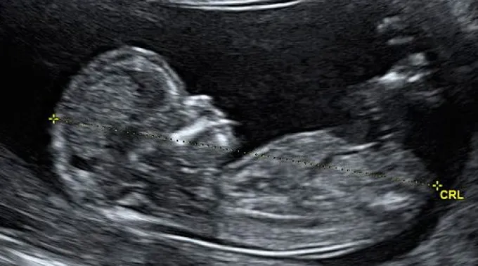 ppecografia091013.jpg ?? 