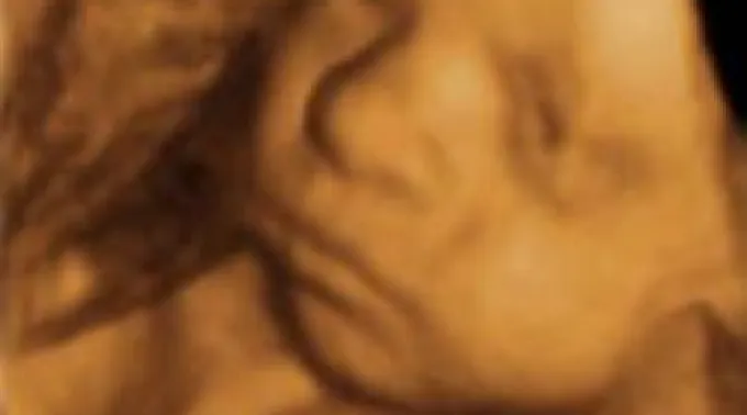 ppecografia260511.jpg ?? 