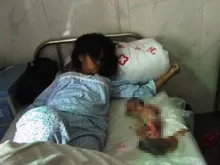 Feng Jianmei e seu bebê abortado