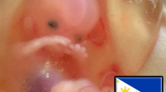 ppfetofilipinasaci170211.jpg ?? 